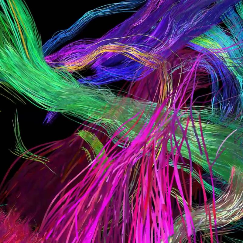 Werbewirkung messen Media Insight 360